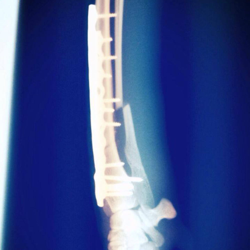 費用一覧｜イタグレbuono骨折治療